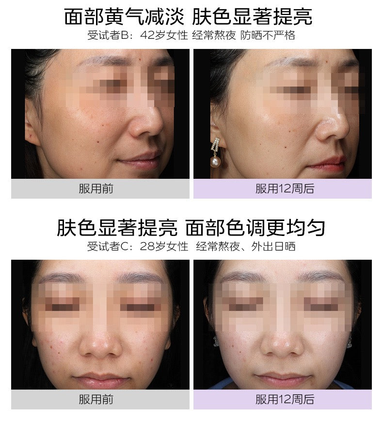 【P703】💥新会员限时专享💥✨喝出白皙肌✨VIDA GLOW 美白胶囊 配套组合 💛