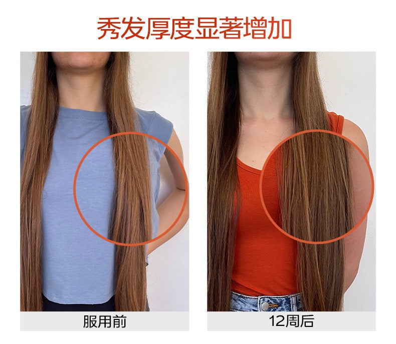 【P728】💥新会员限时专享💥✨胶原配合生发套组 ✨VG 胶原蛋白精准肽 + 蘊发胶囊 配套组 ❤️