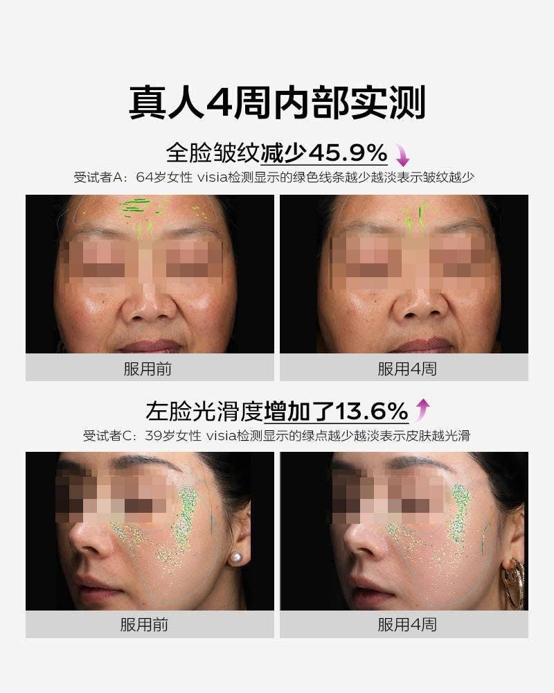 【P705】💥新会员限时专享💥✨养成美白肌✨ VIDA GLOW 美白胶囊+胶原蛋白肽饮/粉组合 💛