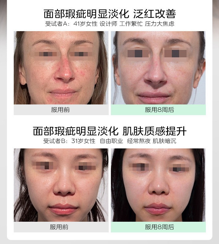 【P700】💥新会员限时专享💥✨瑕疵换皮亮✨ VIDA GLOW 美白胶囊 + 滤镜胶囊PLUS 💛