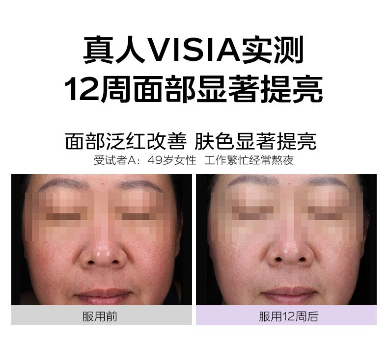 【P703】💥新会员限时专享💥✨喝出白皙肌✨VIDA GLOW 美白胶囊 配套组合 💛